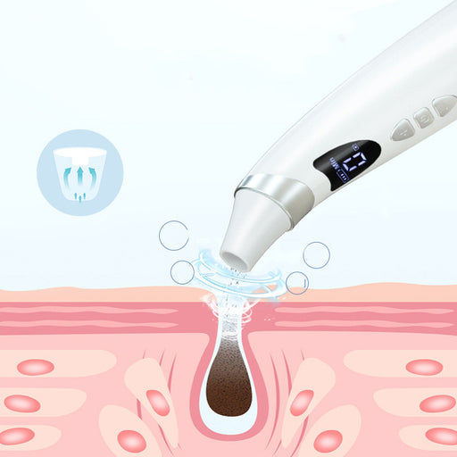 Electric Pore Cleaner